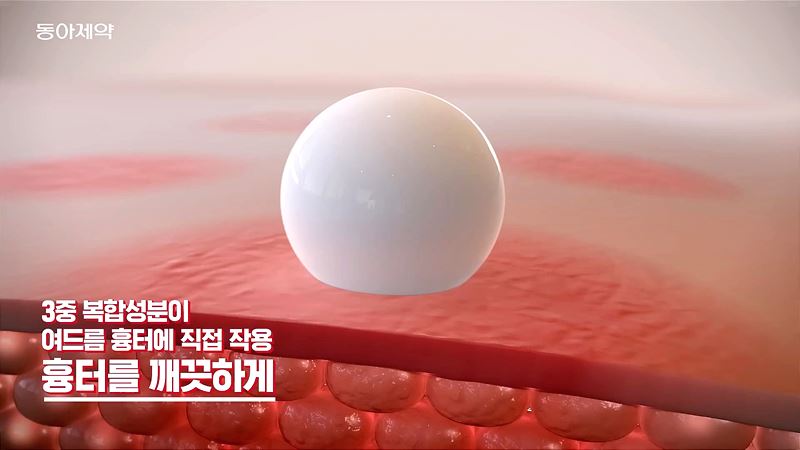 노스카나 연고 사용법