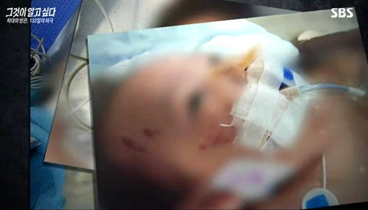 여수 해든이 학대 증거